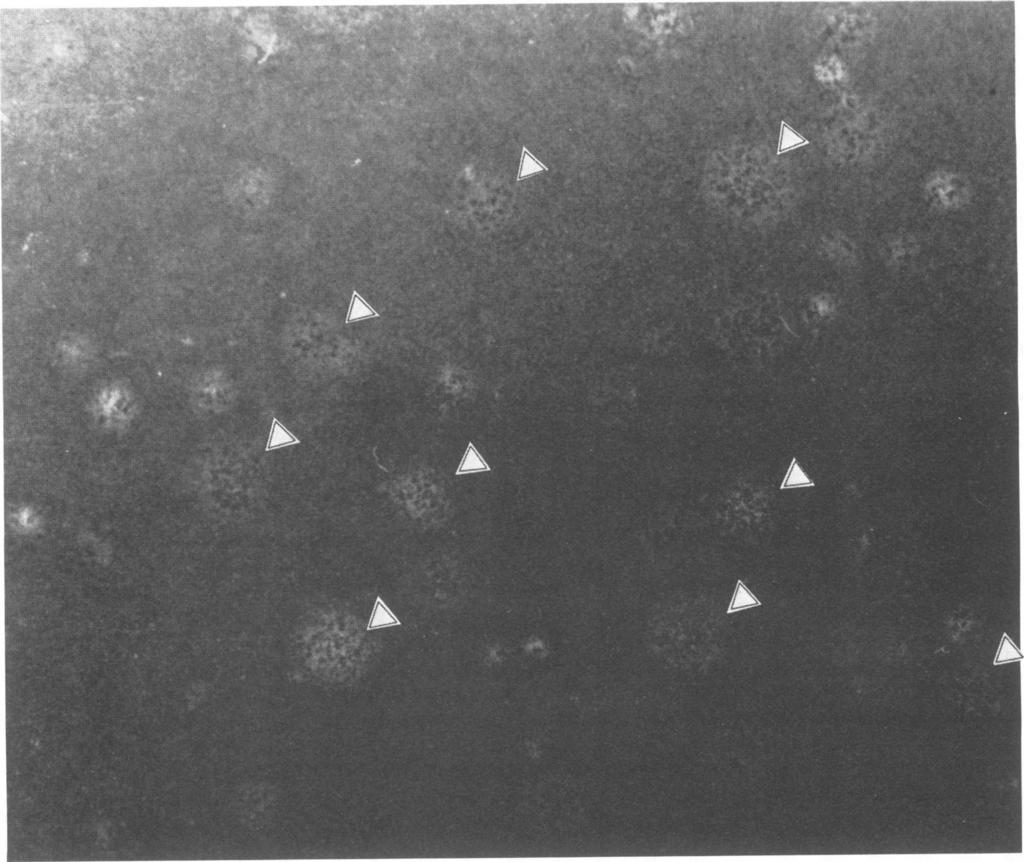3628 KONDO AND MAEDA J. VIROL. FIG. 3. Heterogeneous plaques produced on a BmN cell monolayer from BmNPV- and AcNPV-coinfected SF-21 culture fluid at 72 h p.i. Arrowheads indicate plaques indistinguishable from original BmNPV plaques.