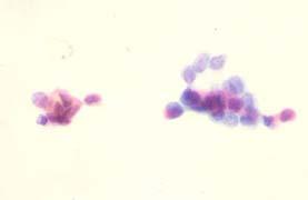 anesthesia Air drying Thyroid FNA