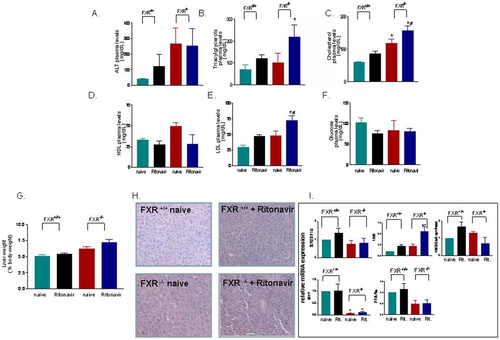 Figure 3. FXR gene ablation worsens the severity of dyslipidemia caused by ritonavir. Panel A F.