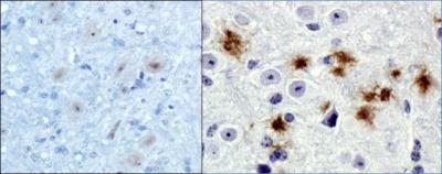 Images Immunohistochemistry: beta Amyloid Antibody (MOAB-2) [NBP2-13075] - IHC analysis of beta Amyloid on normal mouse brain (left) and 5xFAD mouse brain (right) using DAB with
