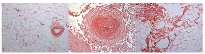 Figure 9: histological results of untreated skin, and