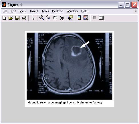 the image back to better quality, or closer to the original. MATLAB and ImageJ are helpful tools for image restoration.