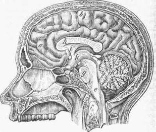 http://chestofbooks.com/reference/american-cyclopaedia-8/images/the-brain-enclosed-in-its-membranes-and-the-skull.