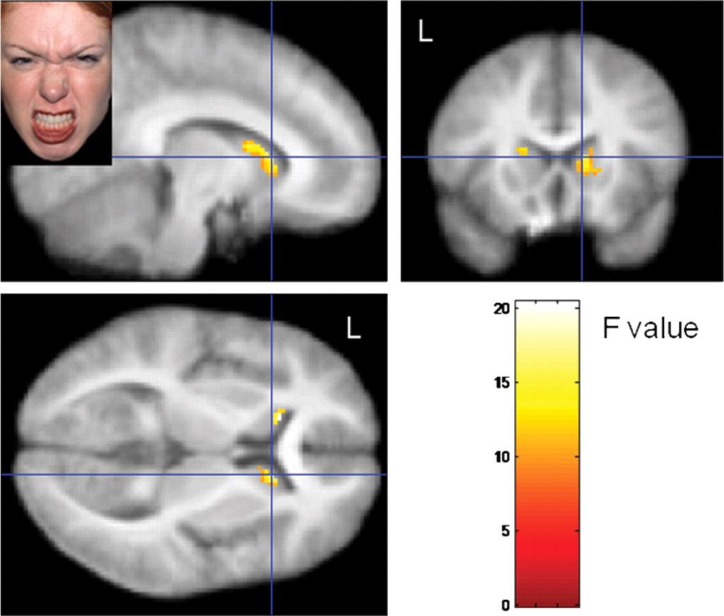 Individuals high in npower Stronger bilateral activation in response to anger faces in the anterior caudate and the anterior insula, Suggests more primed to recruit behavioral routines to cope with