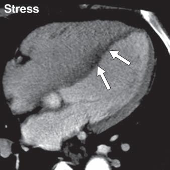 Dual Energy CT 75-year-old man