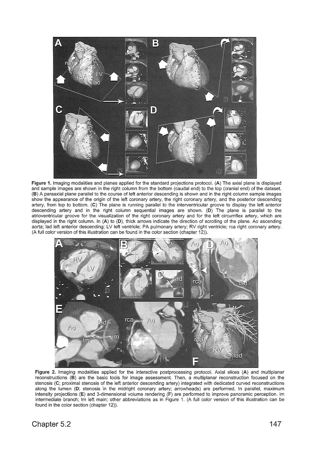 Figure 1. Imaging modalities and planes applied for the standard projections protocol.