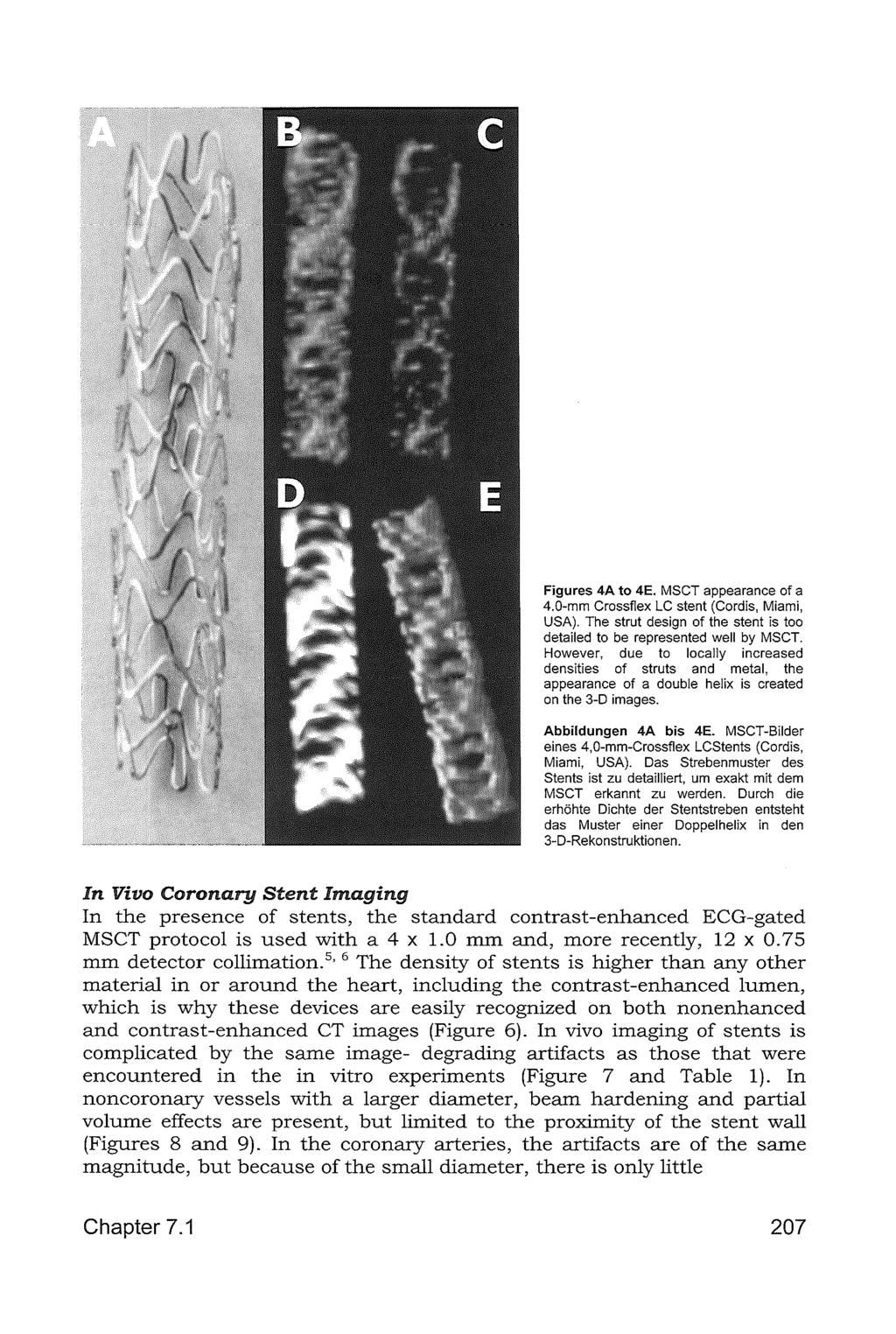 Figures 4A to 4E. MSCT appearance of a 4.0-mm Crossflex LC stent (Cordis, Miami, USA). The strut design of the stent is too detailed to be represented well by MSCT.