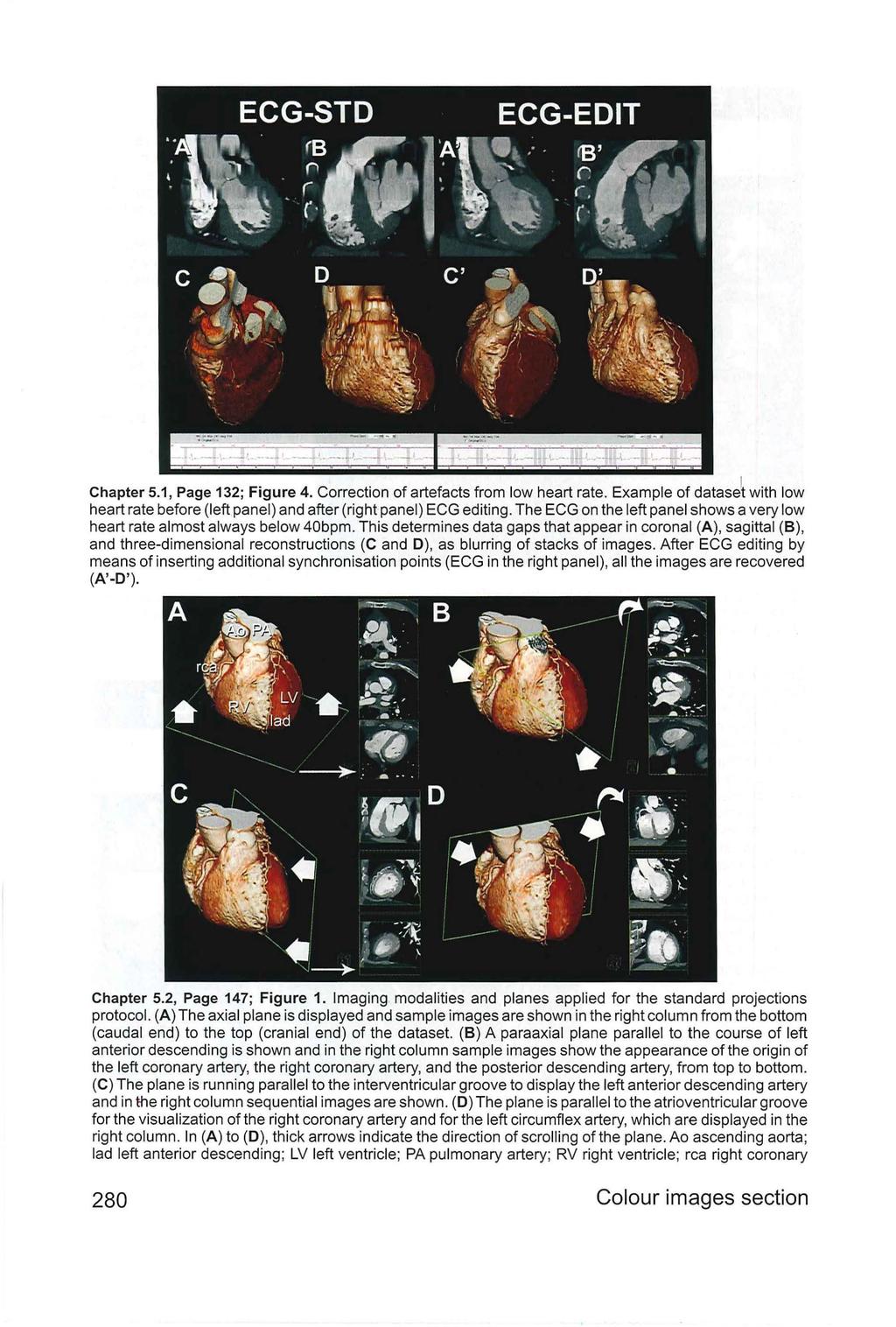 Chapter 5.1, Page 132; Figure 4. Correction of artefacts from low heart rate. Example of datase~ with low heart rate before (left panel) and after (right panel) ECG editing.