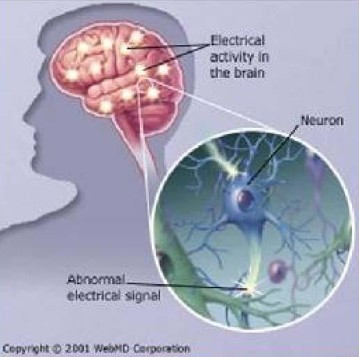 Human Brain Million of neurons fire together Each mental