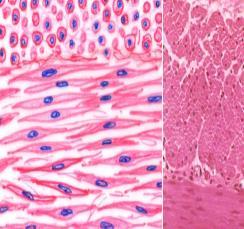 I. 3 Types of Muscle Tissue 1. Smooth 2. Cardiac 3.