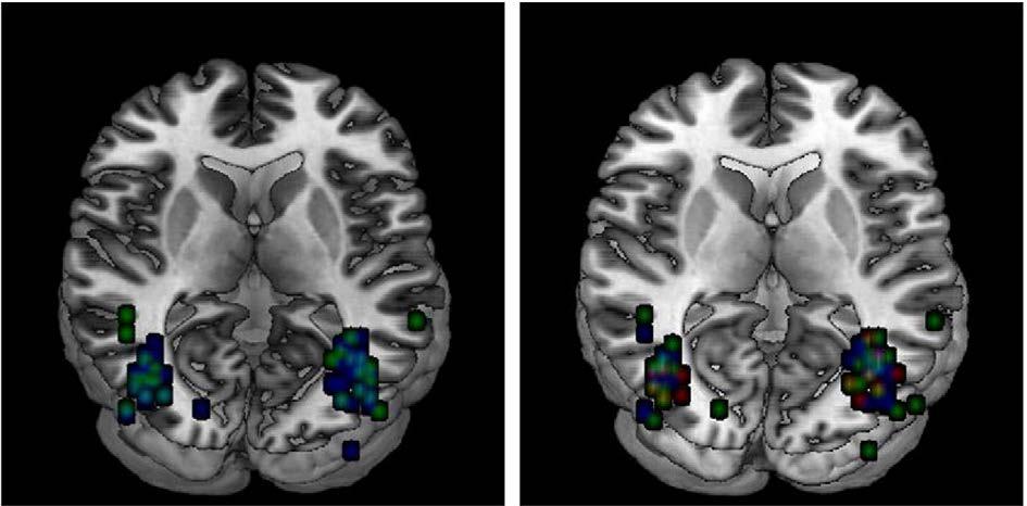 58 M.G. Berman et al. / NeuroImage 50 (2010) 56 71 Fig. 1. Peaks for different localizer task types (left). 1-back are in green, passive-viewing in blue.