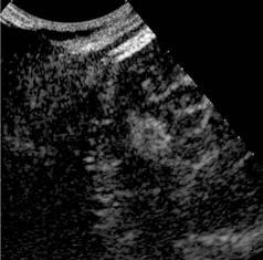Ultrasound 11 a b c d e f g Fig.