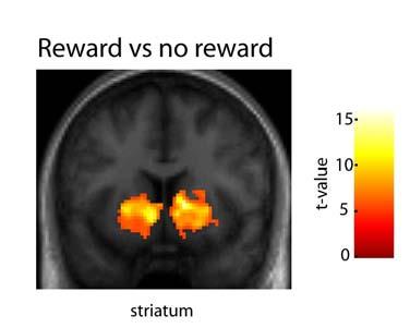 Figure S1. Brain Regions More Activated in Successful vs. Unsuccessful Trials, Related to Figure 1 Stronger activations were seen bilaterally in the striatum (y=8).