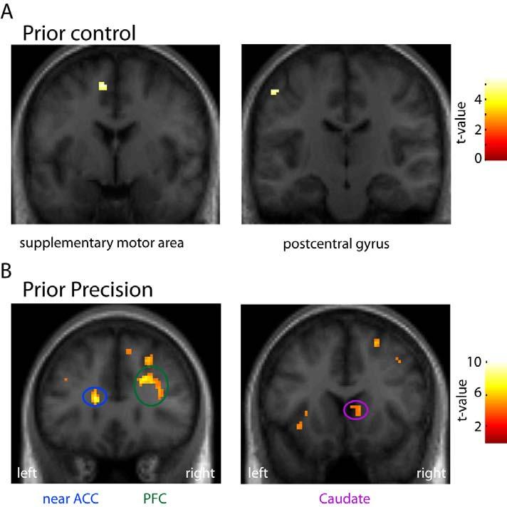 Figure S3. Prior Control Task and Prior Precision Results, Related with Figure 3 (A) Brain regions activated during the control task, for the high uncertainty prior conditions.