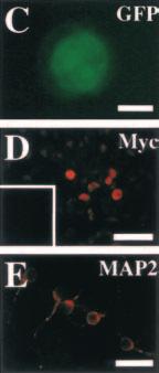 The single neurosphere cells from PS1 +/+ and PS1 / mice differentiated into neurons, astrocytes, or oligodendrocytes in vitro, showing that the neural stem cells were multipotent.