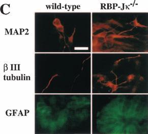 Notch signaling, a PS1 / ;PS2 / genotype, or alternatively a RBP-J / genotype, is required.