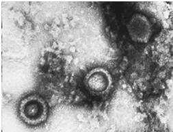 characteristic for each virus History of herpesviruses Herpes infection described by Hippocrates 1875 Varicella determined to be infectious 1954 Varicella isolated in culture