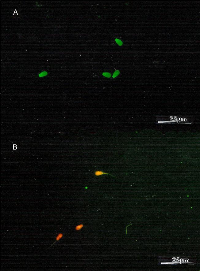 Evaluation of DNA status of freeze-dried bovine sperm 99 Figure 1. Acridine orange test applied to freeze-dried bovine spermatozoa, using TCM 199 with Hank s salts. A. Spermatozoa with intact chromatin (green); B.