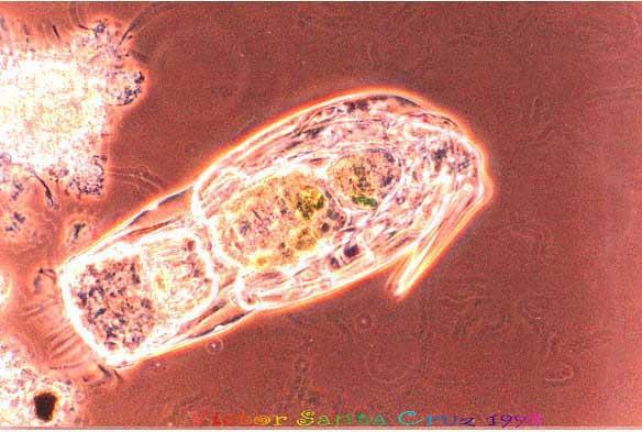 Endogenous Respiration- Phase III Higher life forms such as Metazoa, i.e. Rotifers, worms, etc.