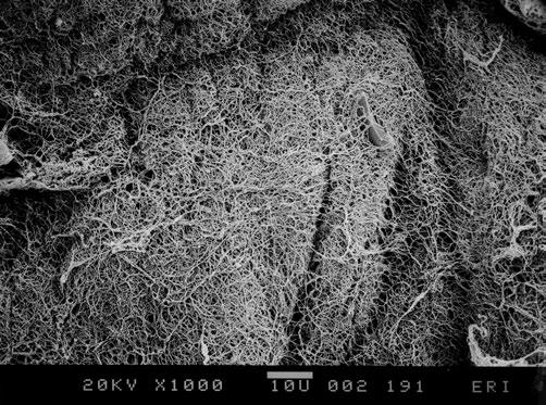 Fig. 3 8 Human posterior vitreous cortex. Scanning electron micrograph of the posterior aspect of the human posterior vitreous cortex after peeling off the retina.
