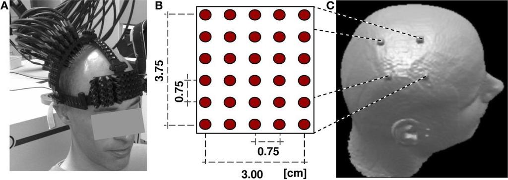 Spatial Resolution In depth: limited to 2-3 cm into the head, deeper is not possible because too few photons will come back -> cortex is only touched Spatial resolution is also 2-3 cm depending on