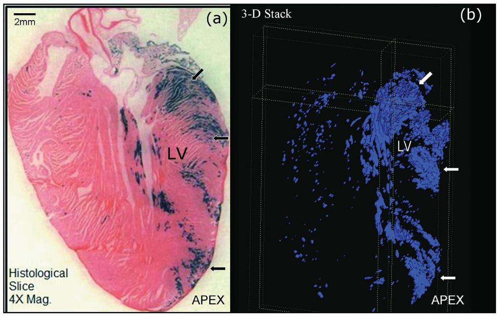 Figure 3: Left ventricle concentration of Pnmt expressing cells. Three dimensional (3D) reconstruction of the XGAL+ staining in the Pnmt+/Cre, ROSA26+/βgal heart Image: Osuala, K., K. Telusma, et al.