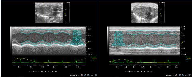 Figure 8: Echocardiography images of left ventricular function of Pnmt-Cre mice (left) and Pnmt-Cre/DTA (right) at baseline.