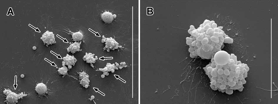 www.karger.com/cpb 329 Fig. 8. (A, B) Representative showing blebbing, a hallmark of apoptosis visualized by SEM. Arrows point to cells with blebbing.. Fig. 9.