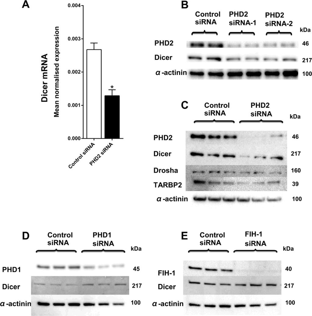 Bandara et al. BMC Cancer 2014, 14:533 Page 8 of 18 Figure 5 Prolyl hydroxylase dependent regulation of Dicer.