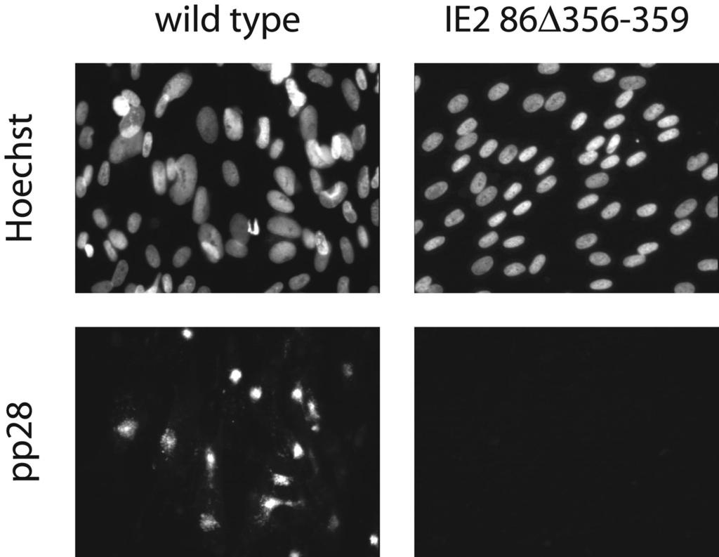 1828 WHITE ET AL. J. VIROL. FIG. 8. pp28 expression in mutant BAC-electroporated cells.