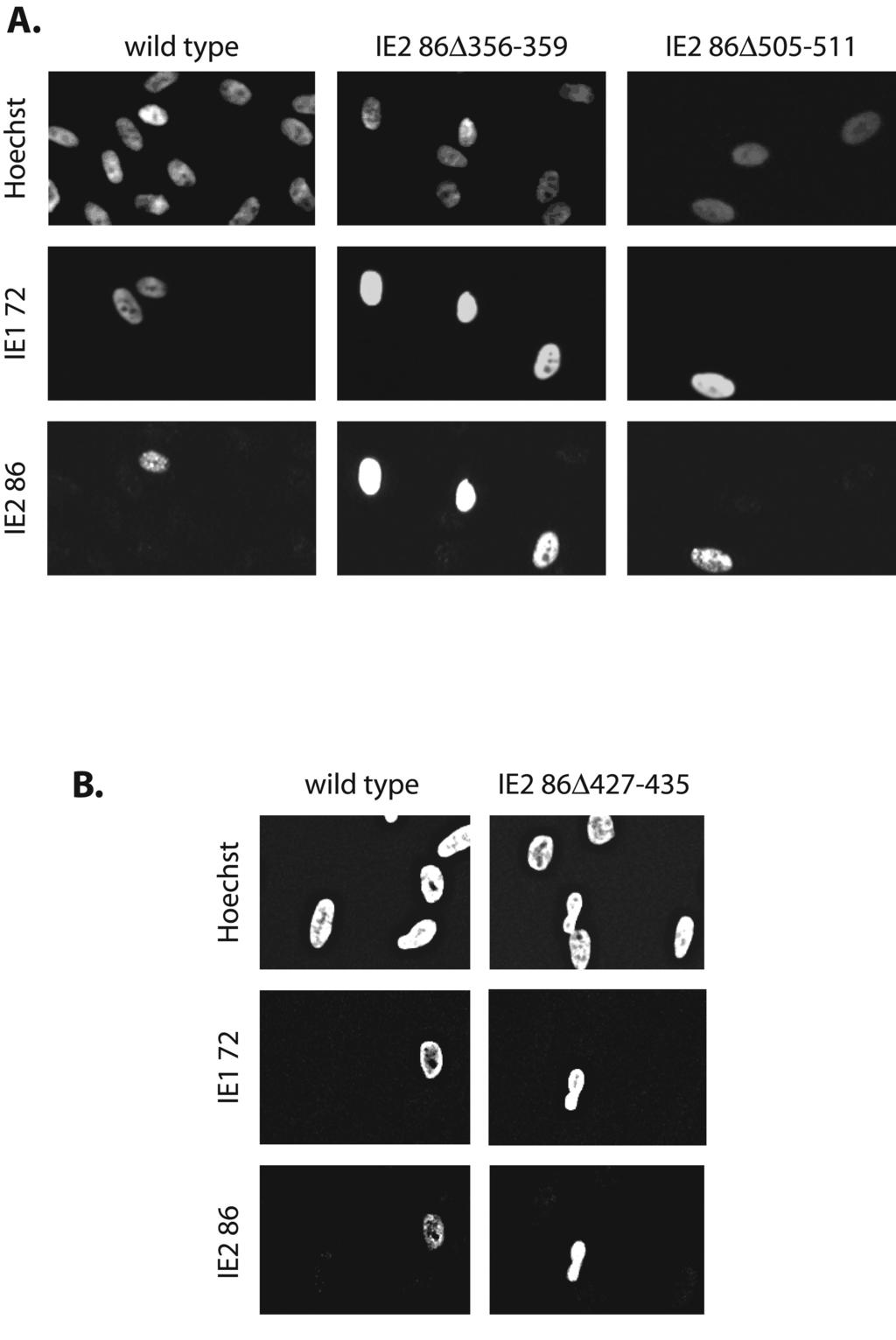 VOL. 78, 2004 CHARACTERIZATION OF NONVIABLE HCMV IE2 MUTANTS 1823 FIG. 3. IE1 72 and IE2 86 expression in wild-type- and IE2 86 mutant BAC-electroporated cells at 1 day postelectroporation.