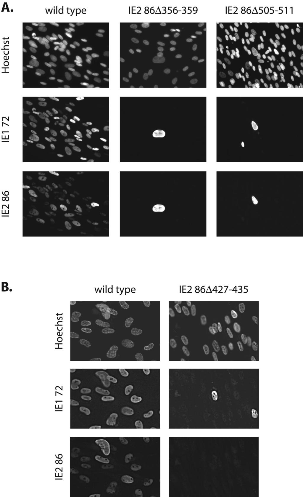 1824 WHITE ET AL. J. VIROL. FIG. 4. IE1 72 and IE2 86 expression in wild-type- and IE2 86 mutant BAC-electroporated cells at 9 days postelectroporation.