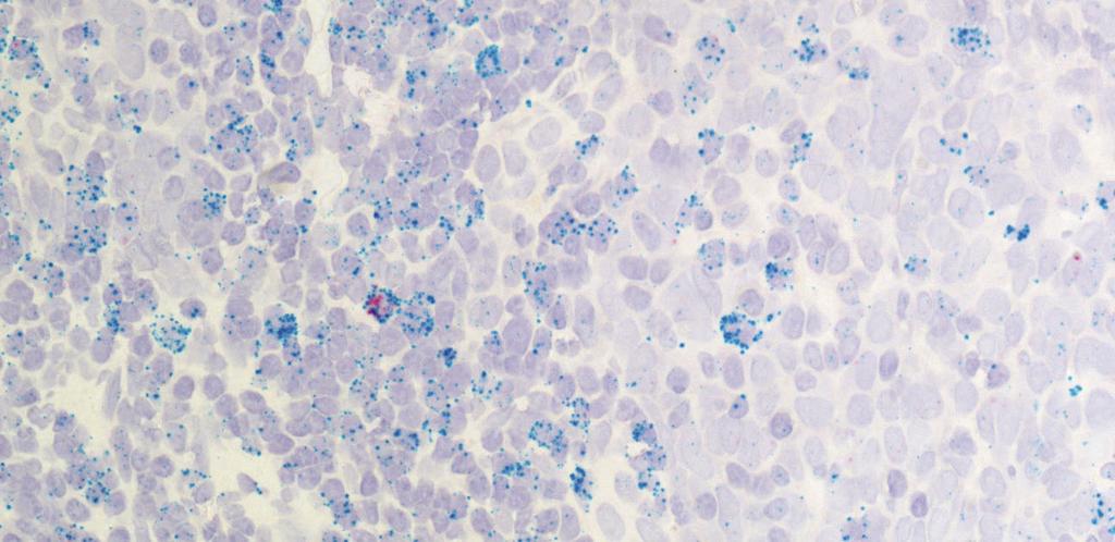 markers CD3 (-), CD8α (C-D), or CD4
