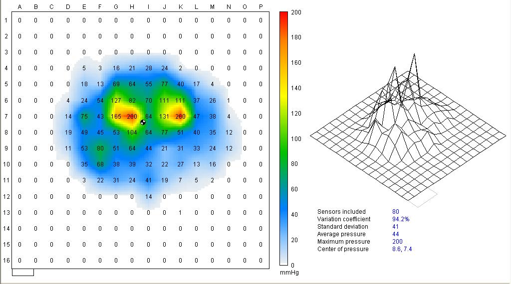 Figure 4-1: Pressure mapping output with colored map of the pressure distribution and numerical values. 4.2.