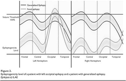 New concept Focal vs Generalized seizure New There is no absolute distinction between generalized and focal epilepsies, but rather a continuum.