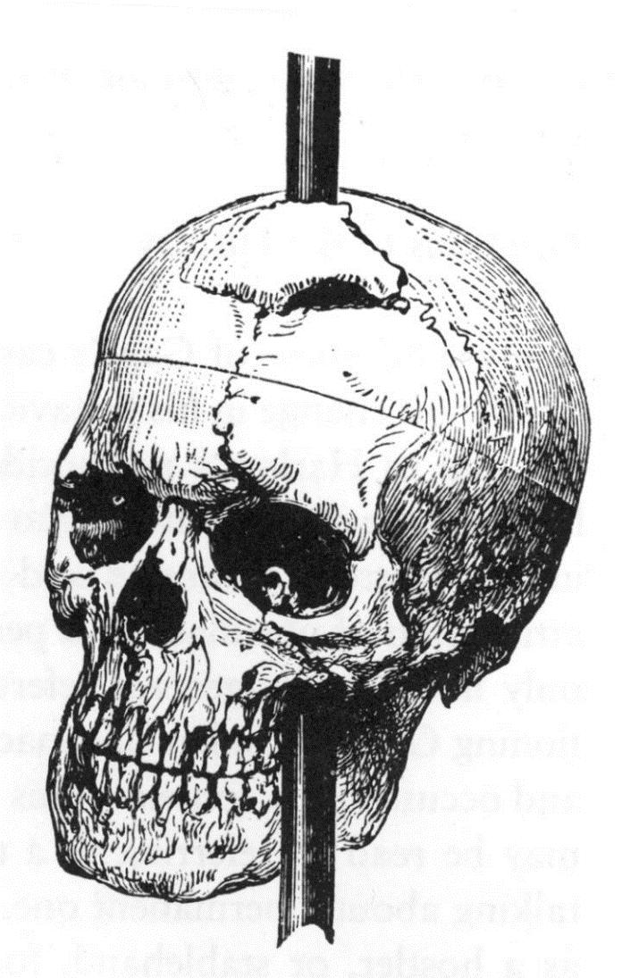 Mechanically Separate Ventral Medial/Orbital Prefrontal Cortex damage Phineas Gage Able to do simple laboratory cognitive tasks BUT show serious deficits