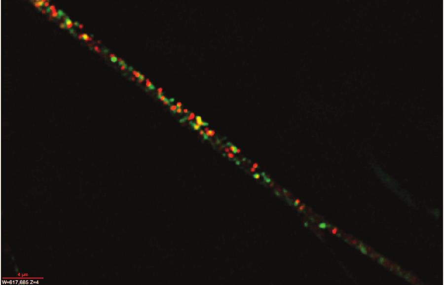 VP5 or gb puncta were counted in 13 F-gI/GFP-infected and 10 F-gI/GFP-R-infected neurons involving four separate experiments.