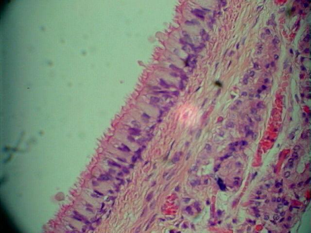 Pseudostratified -(ciliated columnar) lungs Key terms to know: goblet cells and cilia In this image you see (on the left hand side)
