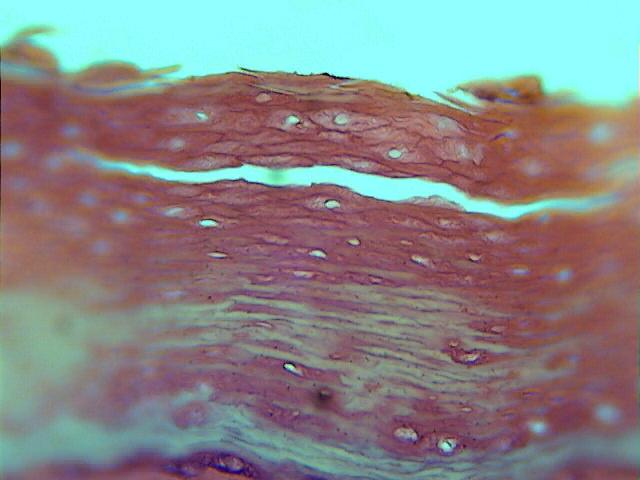 On the top of this papilla are many layers of flat cells (stratified squamal epithelium).