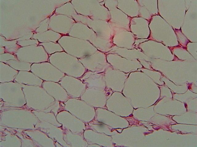 Adipose - matrix contains sparse amount of all three fibers; adipocytes have a flattened