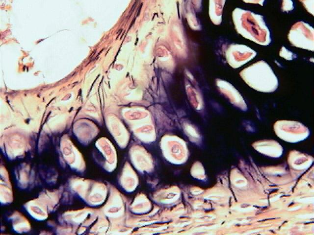 chrondrocytes located within lacunae (spaces); found in ribs, nose, trachea,