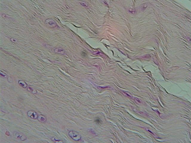 Fibrocartilage - matrix similar to hyaline but less firm and also contains more and thicker collagen fibers;