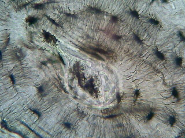 (slides may not be available) Bone (osseous) - hard, calcified matrix containing many collagen fibers;