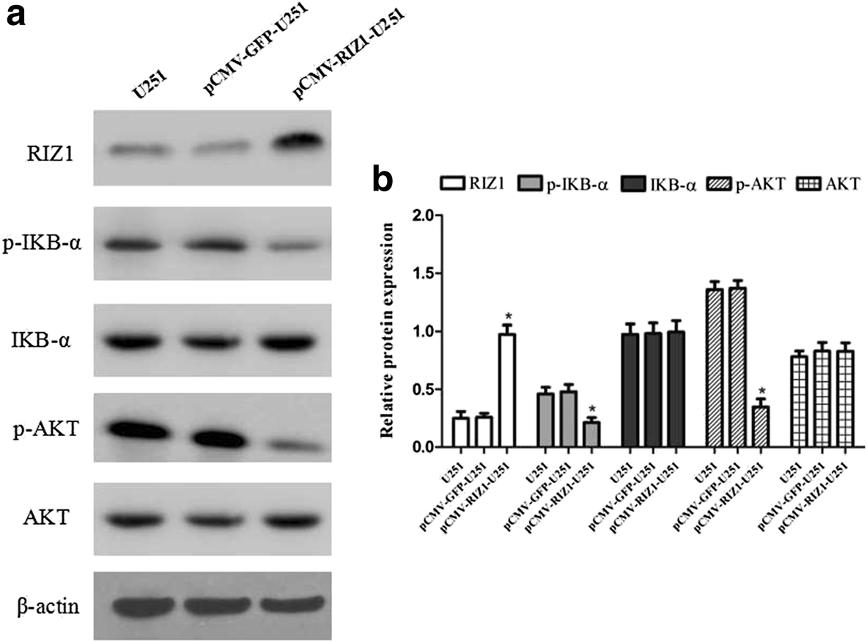 Zhang et al. BMC Cancer (2015) 15:990 Page 11 of 12 Fig. 11 Western blotting analysis of pcmv-riz1 transfection for 72 h on p-ikbα, IKBα, p-akt and AKT expression in U251 cells.
