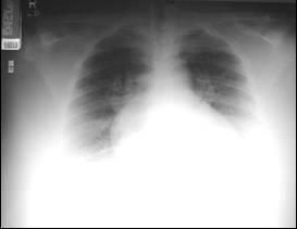Technique? Quality? 13 Chest Radiograph Interpretation Ensure correct film is of the correct patient Are there old ones to compare?