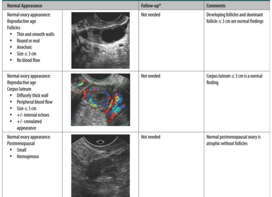 7 OVARIAN AND ADNEXAL CYSTS - NORMAL APPEARANCES Note post-menopausal simple