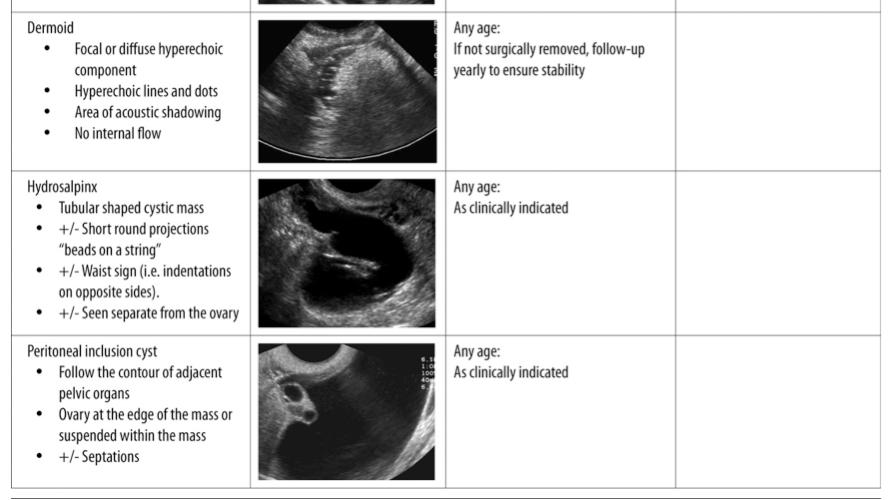 Management of Asymptomatic Ovarian and Other Adnexal Cysts Imaged at US: