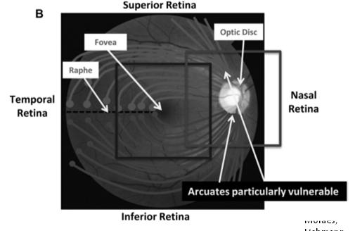 location in space FDOCT makes evaluation of the macula and RGC+ layers possible! 1.