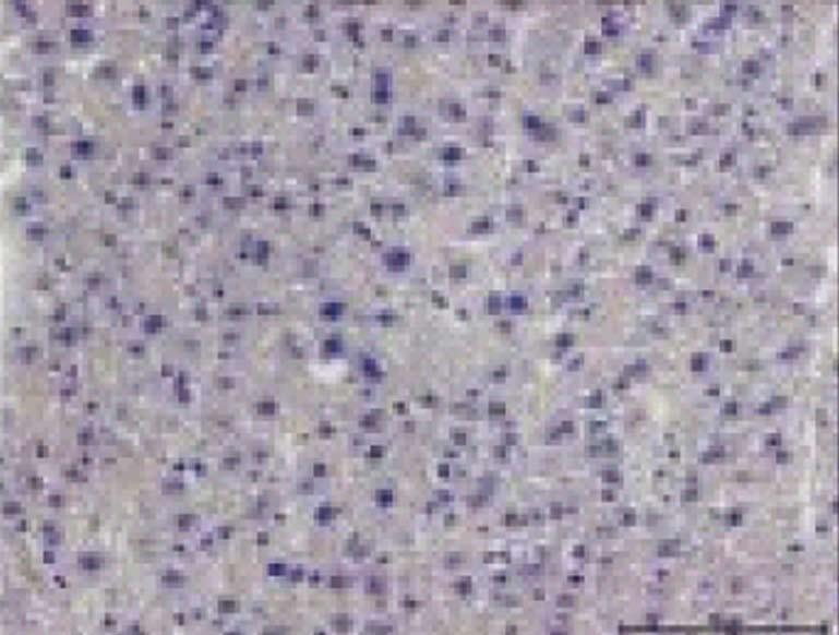immunohistochemistry of heptic sections (mgnifiction ) from ll experimentl groups t 15 wk.