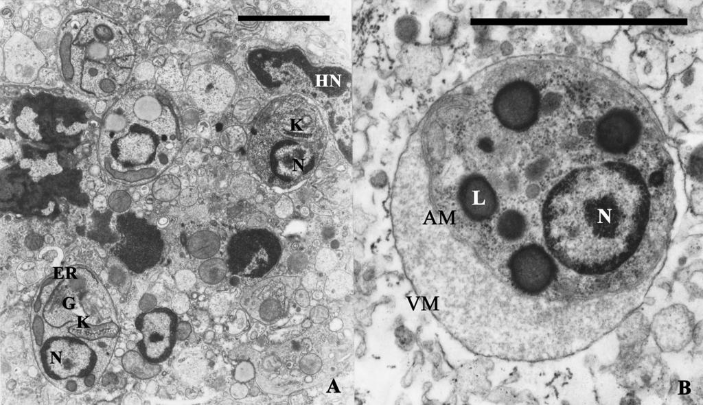 554 THE JOURNAL OF PARASITOLOGY, VOL. 91, NO. 3, JUNE 2005 FIGURE 3. Transmission-electron microscopy of tissue amastigotes of Leishmania (Viannia) lainsoni. A. Intracellular amastigote form.